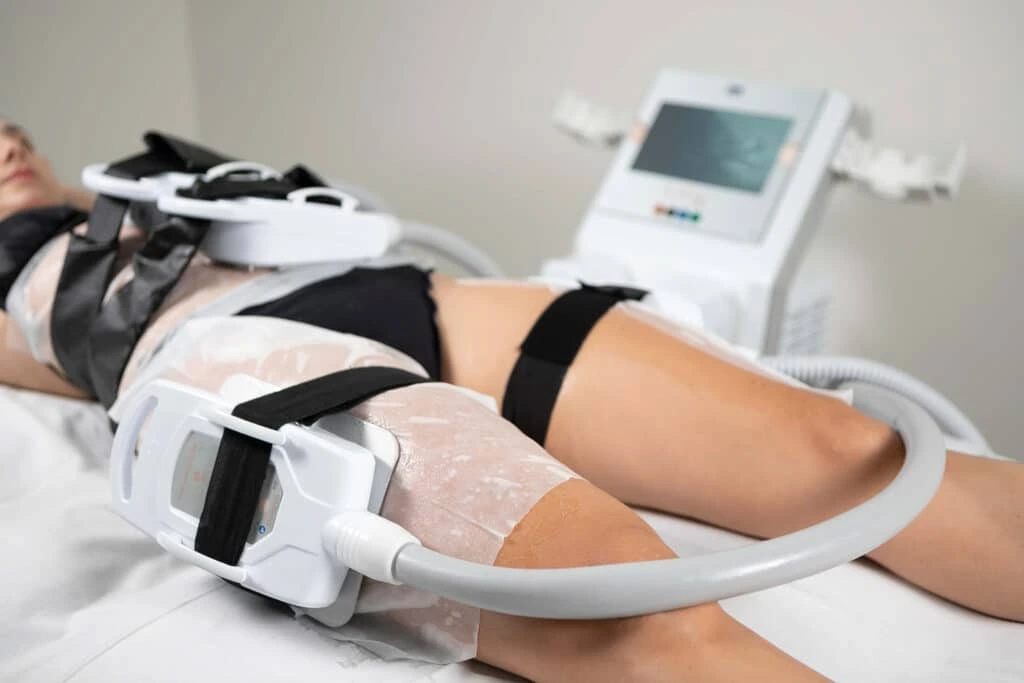 Criolipólise de Placas